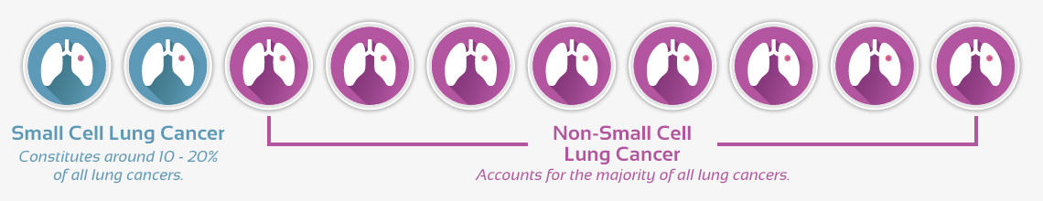 Small Cell Lung Cancer - Constitutes around 15% of all lung cancers. Non-Small Cell Lung Cancer - Accounts for the majority of all lung cancers.